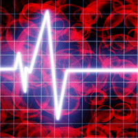 metabloic syndrome and your heart beat